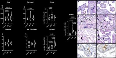 Placental Morphologic Similarities Between ZIKV-Positive and HIV-Positive Pregnant Women